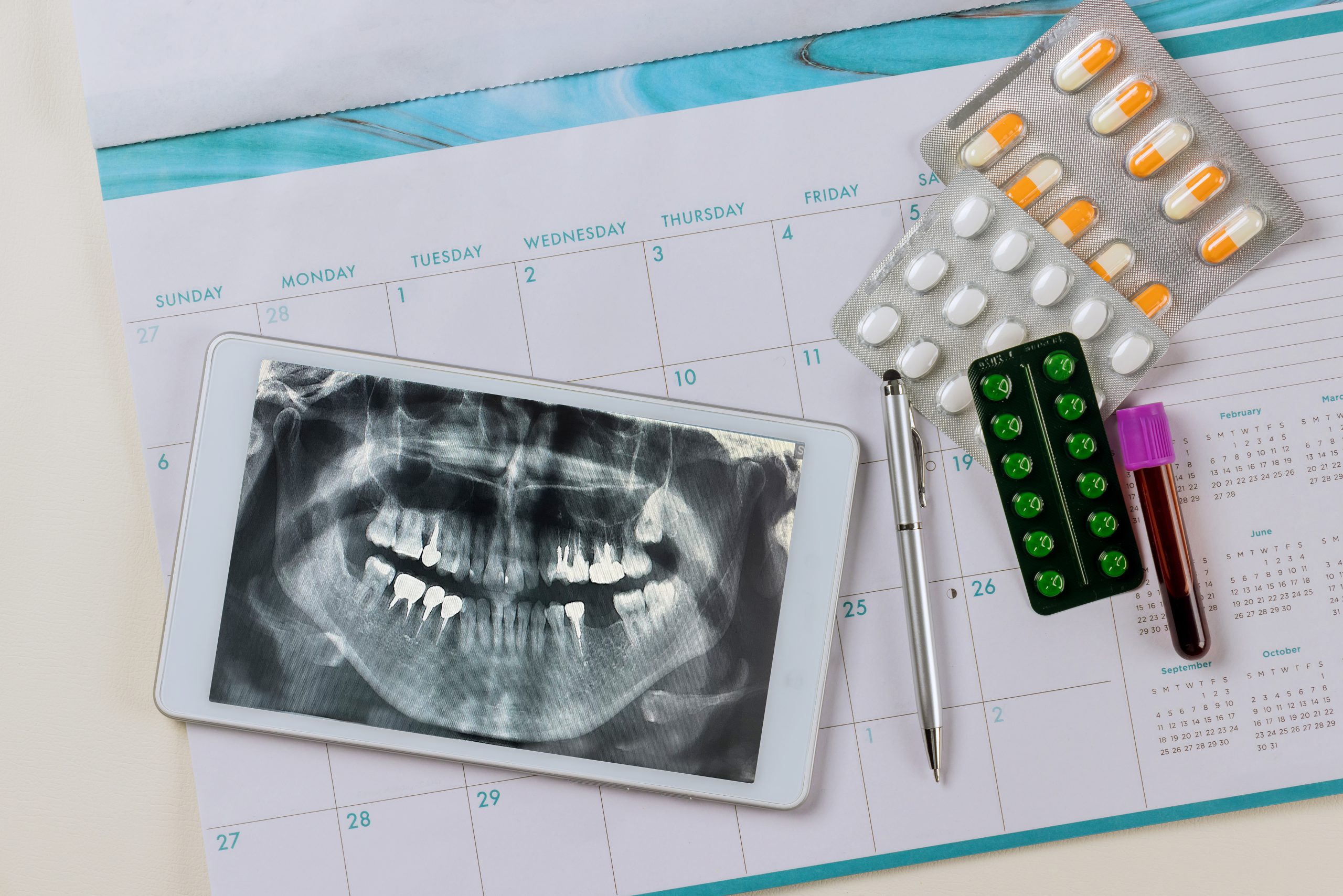 Diş implantı için çekilen bir röntgen filmi
