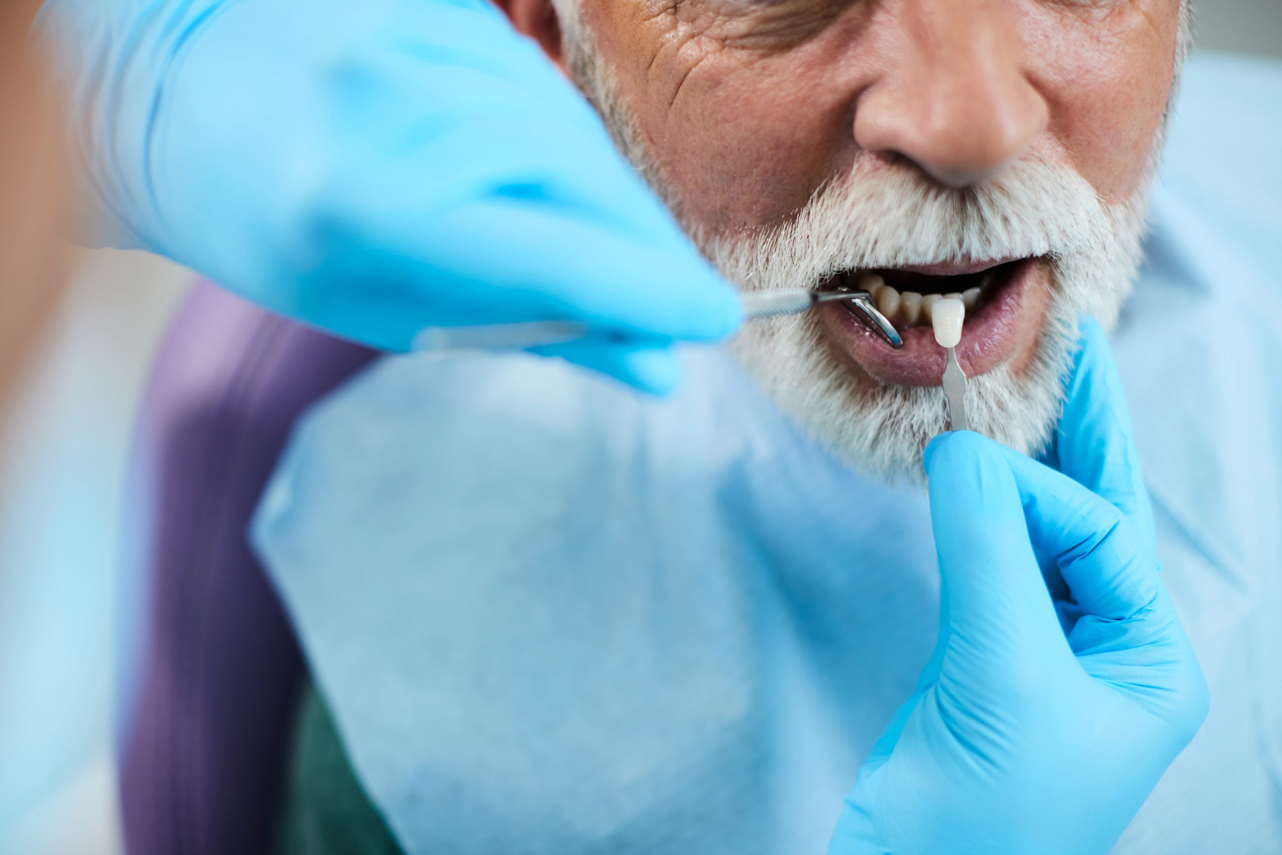 Dental operation failure may happen on treatment