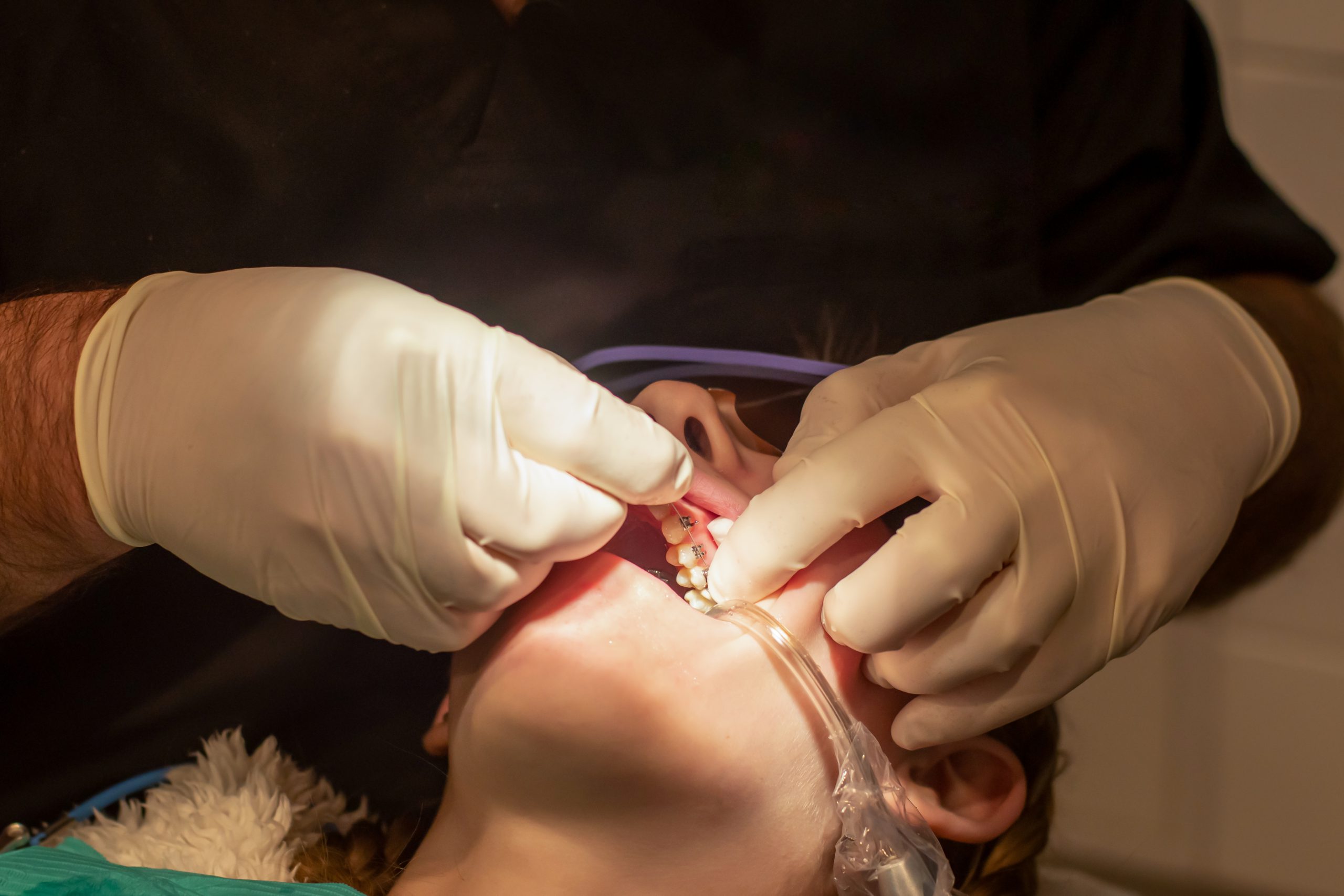 Another dental treatment may save you from dental operation failure