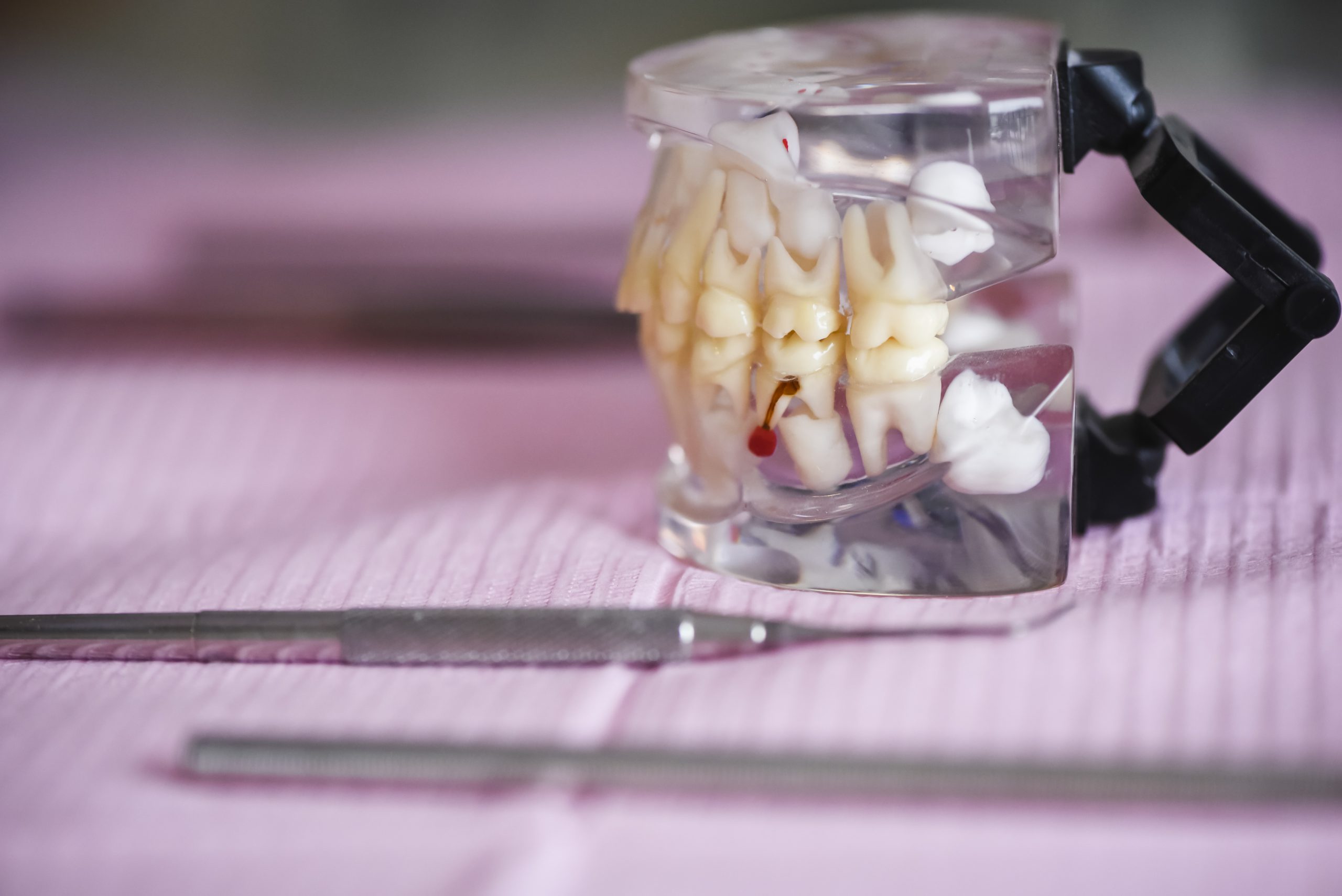 Dental prosthesis can be applied on any teeth.