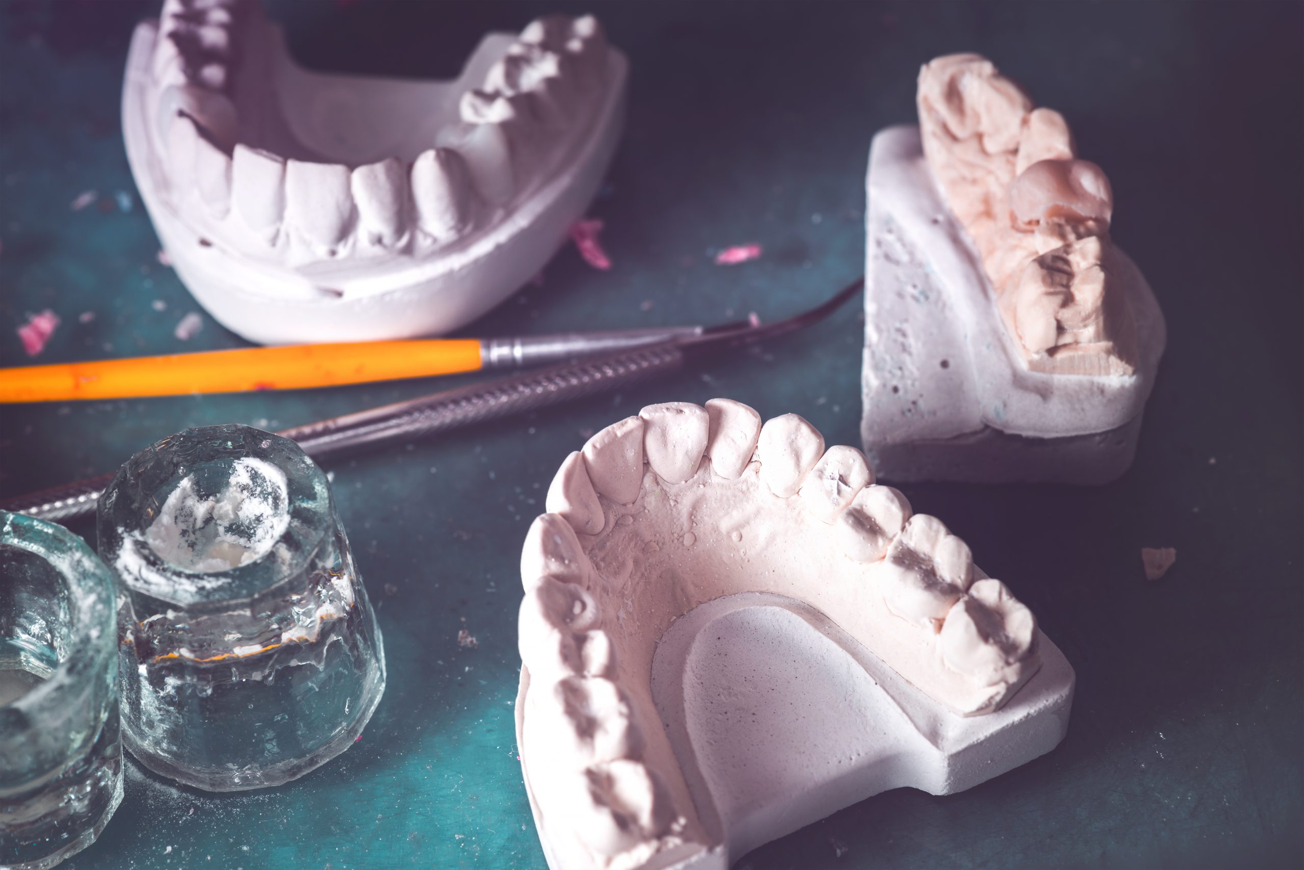 Dental implants can be the keystone of bright smile