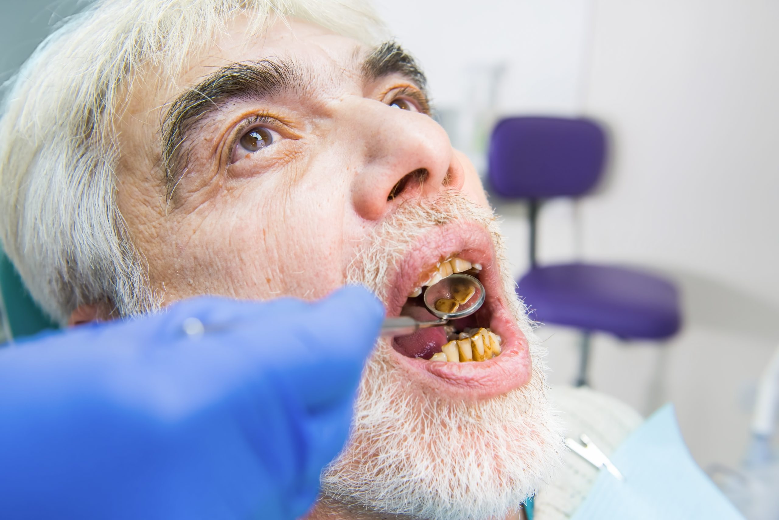 Dental operation failure may happen on procedure