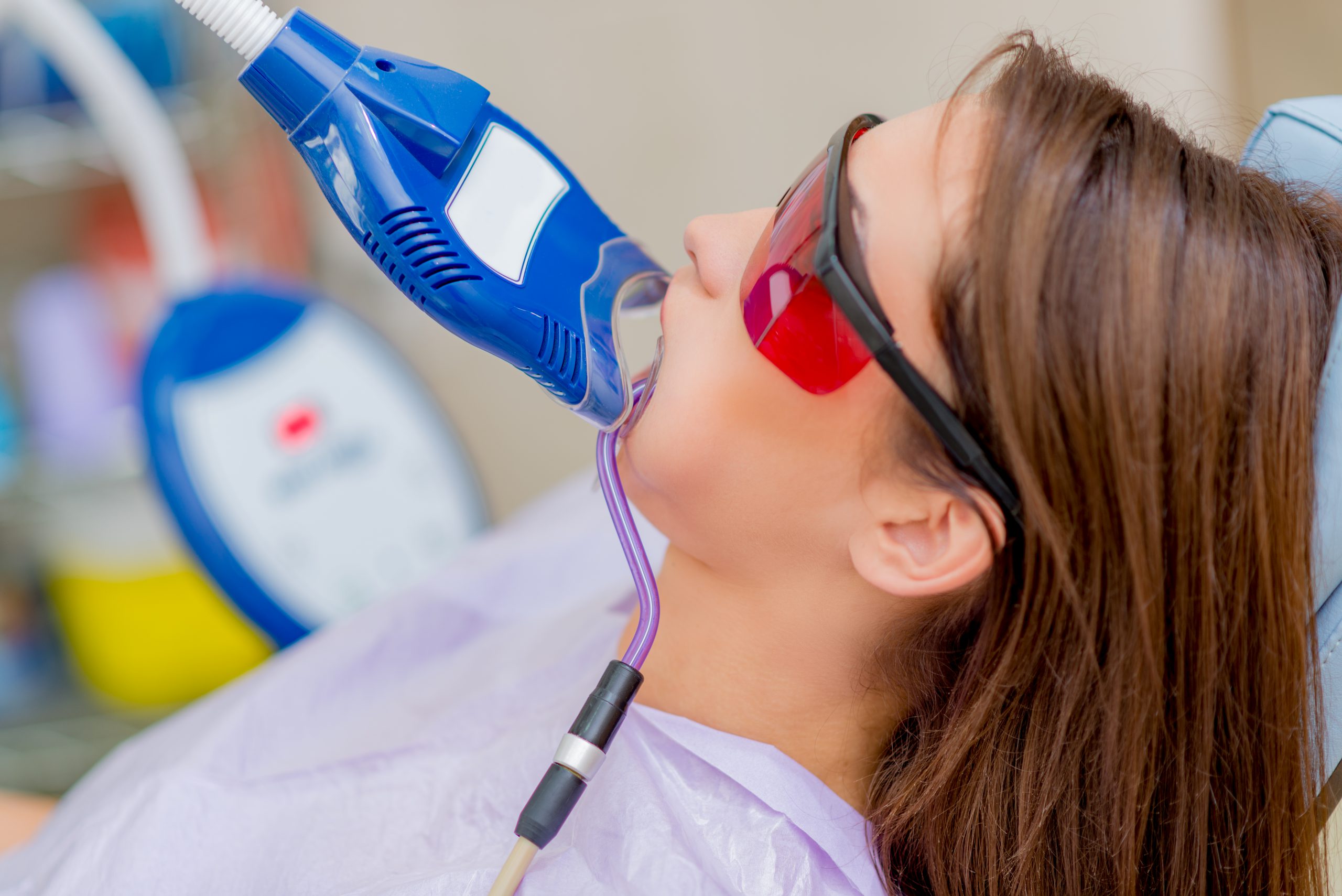 Teeth whitening procedure done at clinic