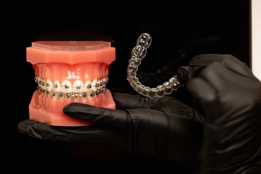 Invisalign and braces