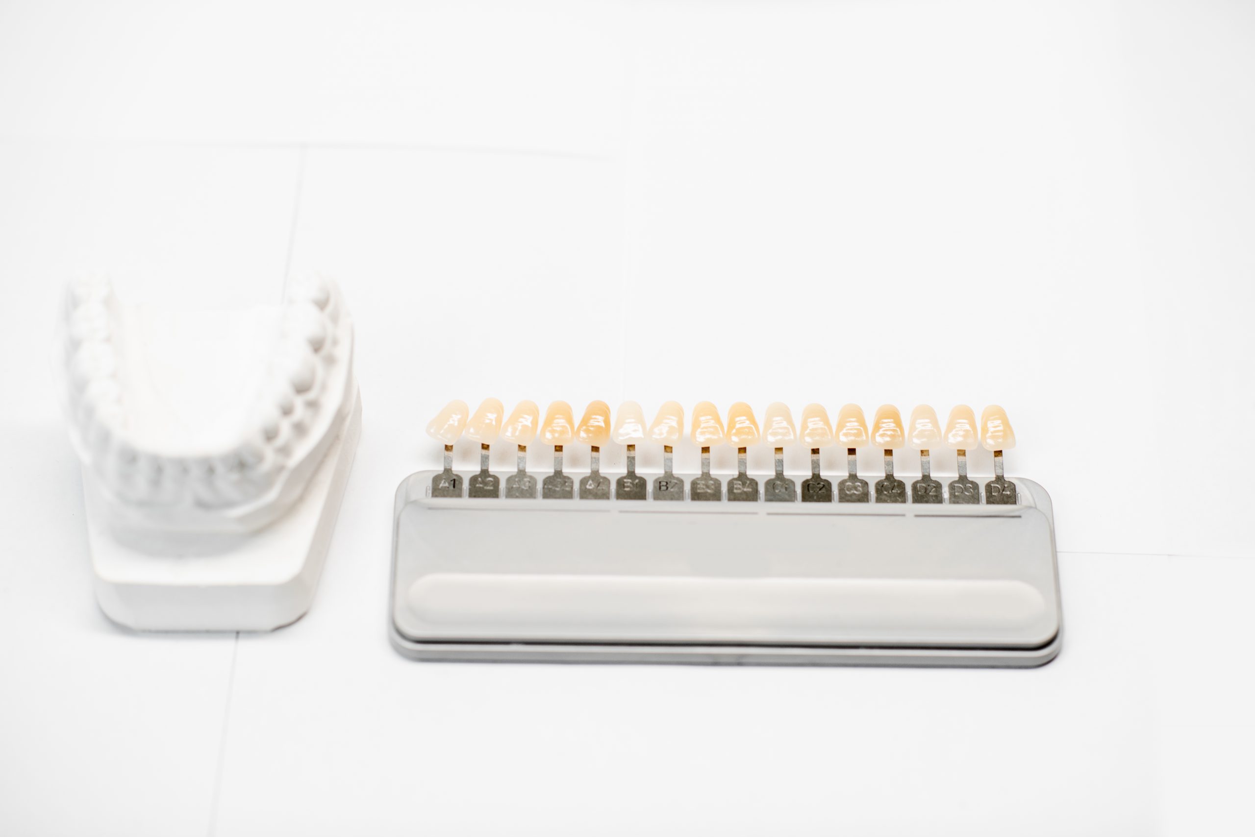 Veneer is commonly used for Holywood smile