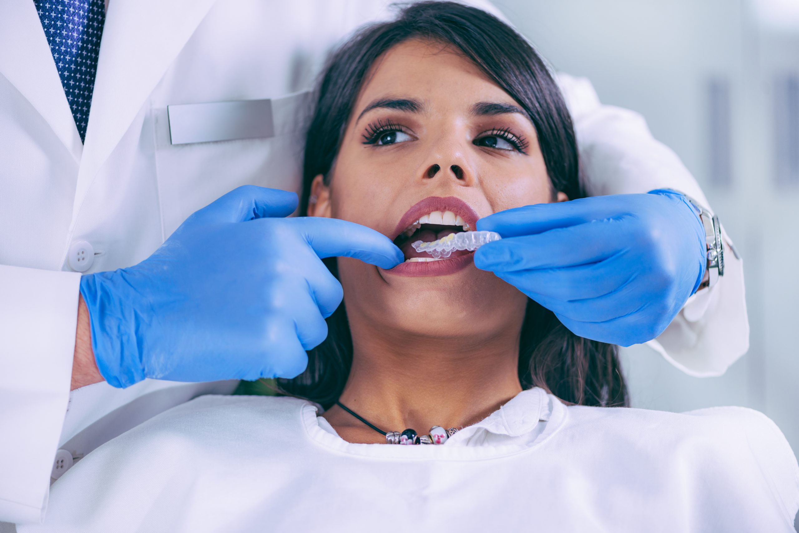 Teeth whitening for hollywood smile