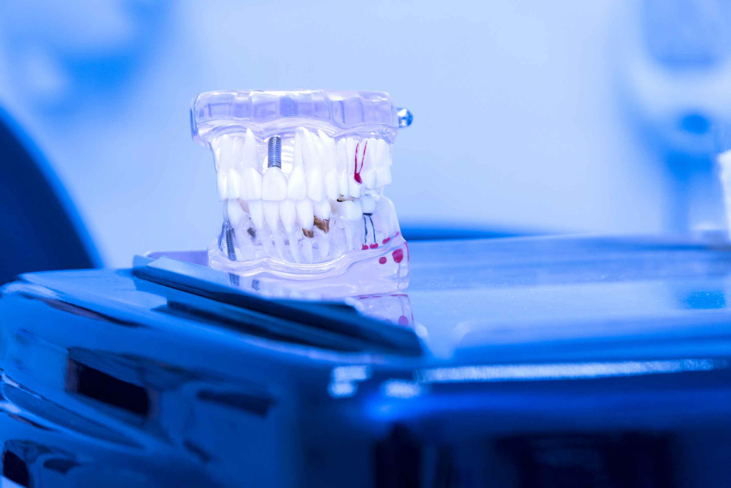 Tooth model on dentist table