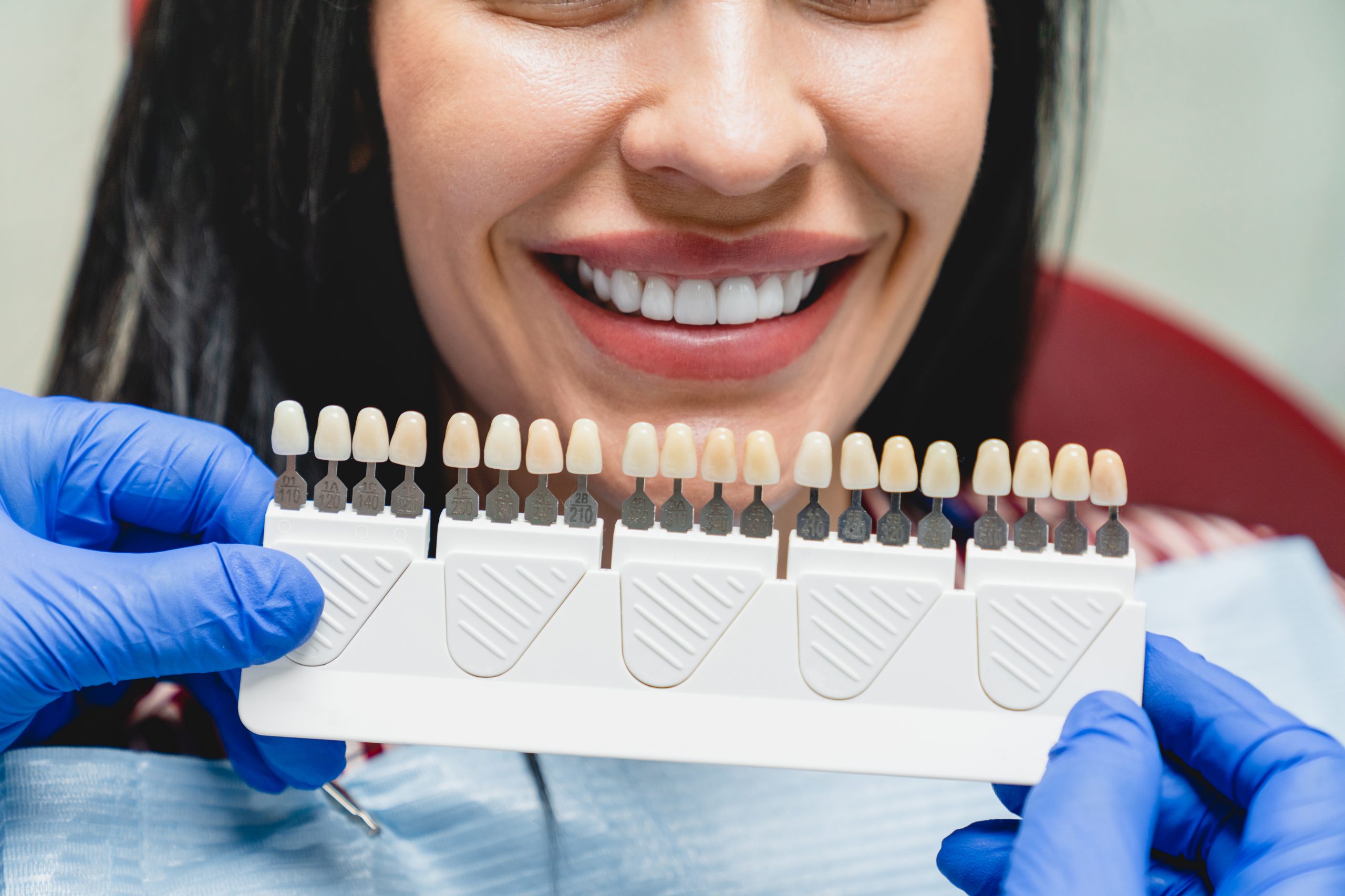 Dental Health NHS insurance coverage