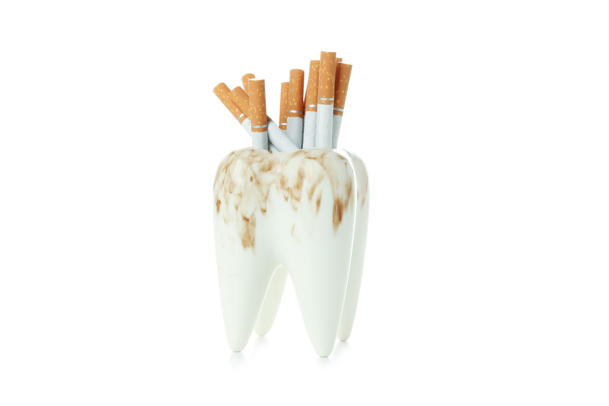 Cigarette is a reason of tooth stain