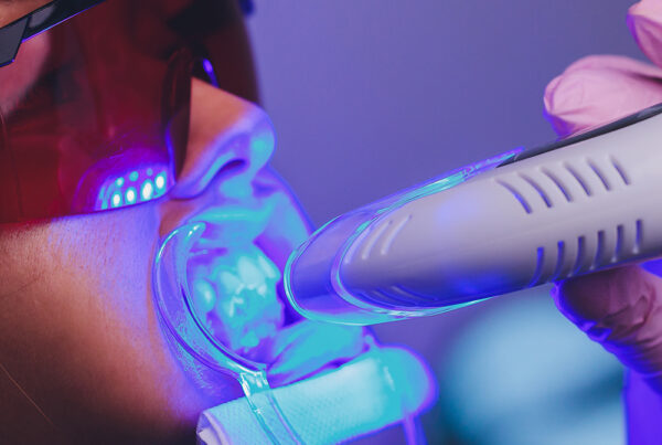 Laser beam device being used on patient for laser teeth whitening procedure