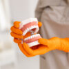 Dental professional holding artificial teeth model with orange gloves during implant consultation