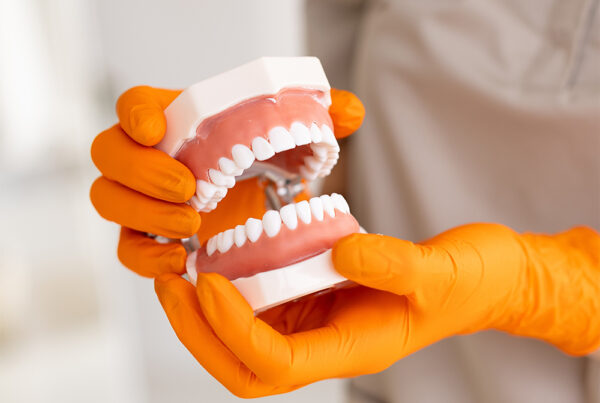 Dental professional holding artificial teeth model with orange gloves during implant consultation