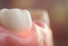 A detailed macro close-up image showing a clean white tooth meeting a healthy pink gum. The focus is on the gumline, symbolizing oral health and the early signs of gum disease.