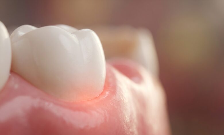A detailed macro close-up image showing a clean white tooth meeting a healthy pink gum. The focus is on the gumline, symbolizing oral health and the early signs of gum disease.