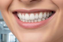 Primer plano fotorealista de una sonrisa radiante y saludable con carillas dentales perfectamente blancas y naturales, ambientada en una clínica dental moderna y luminosa en España con un fondo borroso.