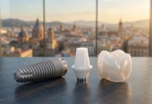 Primer plano fotorealista de los componentes de un implante dental (tornillo, pilar y corona) dispuestos sobre una superficie limpia, con el horizonte de una ciudad española desenfocada y al atardecer en el fondo.