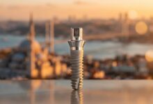 A close-up, photorealistic image of a modern titanium dental implant. The background is a soft-focus, artistic blur of the Istanbul, Turkey cityscape at sunset, representing the concept of dental tourism.