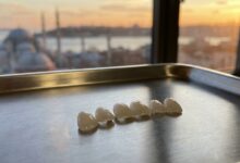 A close-up, photorealistic image of several pristine porcelain veneers on a clean surface, with the iconic skyline of Istanbul, Turkey, beautifully blurred in the background during a warm sunset.