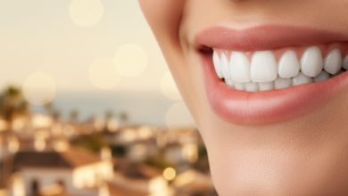 Un sourire radieux et confiant avec des dents blanches et parfaitement alignées, légèrement floues sur les bords. L'arrière-plan est un paysage urbain espagnol ensoleillé, très flou, évoquant une destination de voyage sans détails spécifiques.