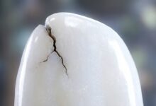 A photorealistic macro image of a perfect white enamel-like surface being compromised by a small, dark crack, symbolizing the beginning of a cavity.