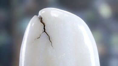 A photorealistic macro image of a perfect white enamel-like surface being compromised by a small, dark crack, symbolizing the beginning of a cavity.