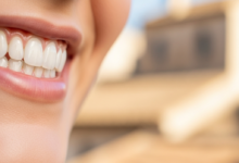 Primer plano de una sonrisa blanca y radiante, con dientes perfectamente alineados y brillantes. El fondo está muy desenfocado, mostrando tonos cálidos y borrosos que sugieren un entorno urbano español soleado.