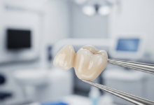 Primer plano fotorrealista de una corona dental de zirconio de color blanco natural, con un acabado translúcido y brillante. La corona está siendo manipulada con pinzas de precisión estériles sobre un fondo suavemente desenfocado de un entorno dental moderno y limpio.