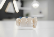 Imagen cercana y detallada de una corona dental de cerámica de alta calidad, con un color blanco natural y una textura brillante y lisa, descansando sobre una superficie estéril. El fondo está suavemente borroso, mostrando un entorno de clínica dental moderno y limpio. No hay texto visible ni elementos que distraigan.