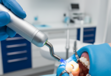 Imagen fotorrealista de un primer plano de un diente siendo restaurado con composite, aislado con un dique de goma. Se ve la mano enguantada de un dentista aplicando luz de fotopolimerización sobre el diente en una clínica dental moderna y estéril.