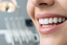 Primer plano ultra-detallado de una sonrisa radiante con dientes blancos, perfectamente alineados y encías saludables, en un entorno dental moderno y difuminado, simbolizando el éxito y la belleza de los implantes dentales.