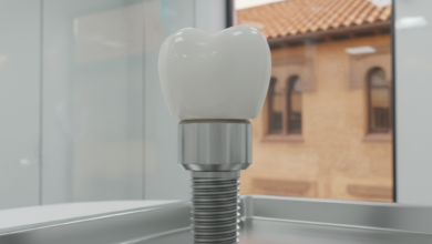 Primer plano fotorrealista de un implante dental de titanio con su pilar y corona de cerámica, presentado en un ambiente clínico estéril y moderno con luz brillante. El implante es el foco principal, con un fondo suavemente desenfocado que sugiere una arquitectura española bajo la luz del sol.