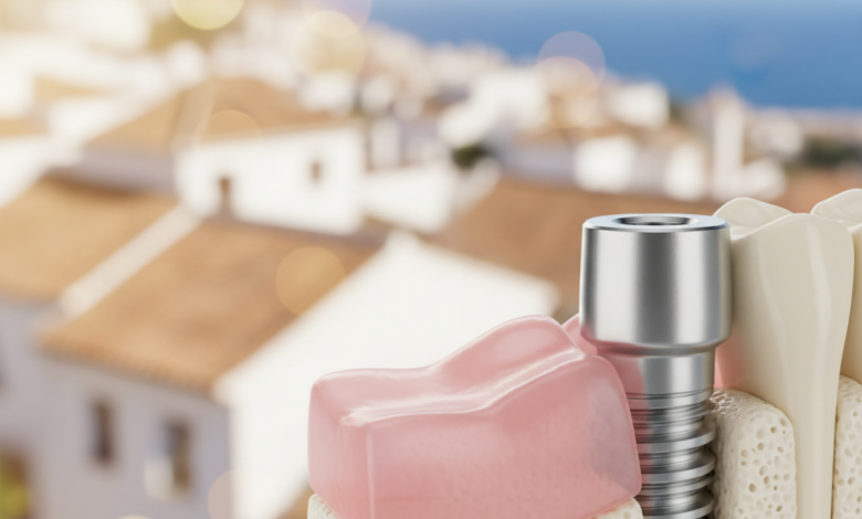 Primer plano fotorealista de un brillante implante dental de titanio insertado en una estructura estilizada de hueso y encía, con un fondo suavemente desenfocado que sugiere un paisaje costero soleado de España.