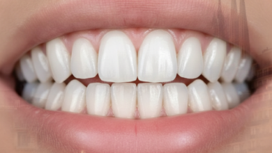 Primer plano fotorrealista de dientes blancos y sanos, con un fondo borroso que sugiere la ciudad de Barcelona, posiblemente mostrando la silueta de un edificio emblemático, sin texto visible.