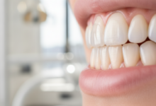 Imagen detallada y fotorrealista de dos dientes. Un diente muestra una fina carilla dental translúcida en la superficie frontal, y otro diente adyacente exhibe una corona dental completa que cubre toda su estructura, ambos con un acabado natural y saludable. Fondo borroso de clínica dental moderna.