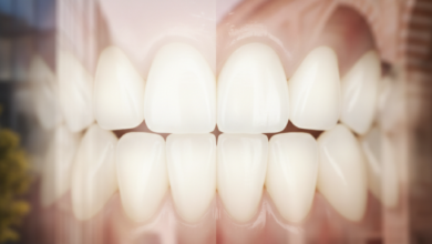 Una imagen conceptual que compara el turismo dental en España y Turquía, con un diente blanco estilizado en primer plano y fondos borrosos que representan sutilmente la arquitectura europea (izquierda) y turca (derecha).