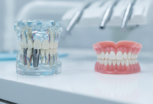 Una imagen fotorealista que compara un implante dental integrado en un modelo de mandíbula con una dentadura postiza en una clínica dental moderna.