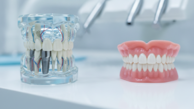Una imagen fotorealista que compara un implante dental integrado en un modelo de mandíbula con una dentadura postiza en una clínica dental moderna.