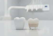 Una imagen fotorealista de primer plano que muestra dos coronas dentales lado a lado. A la izquierda, una corona de color blanco opaco que simboliza la fuerza del zirconio. A la derecha, una corona translúcida y estratificada que representa la estética de la porcelana. Ambas están sobre una superficie limpia con un fondo borroso de un laboratorio dental.
