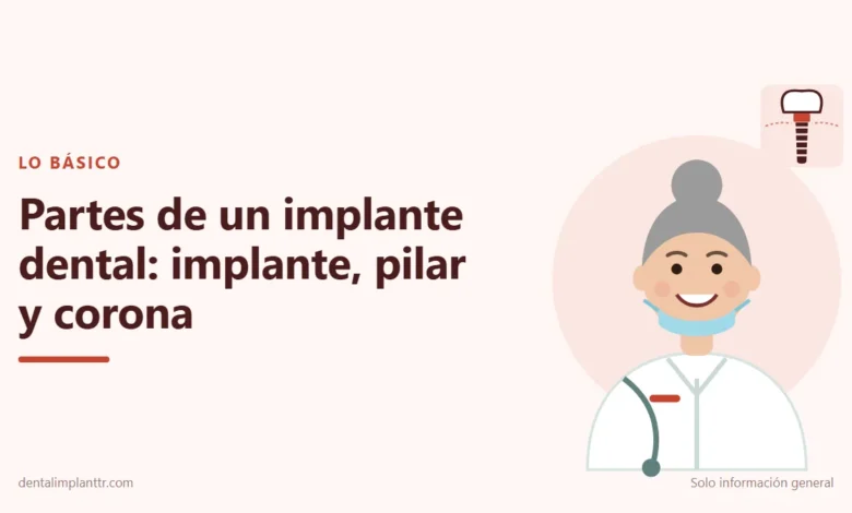 Ilustración: Partes de un implante dental: implante, pilar y corona