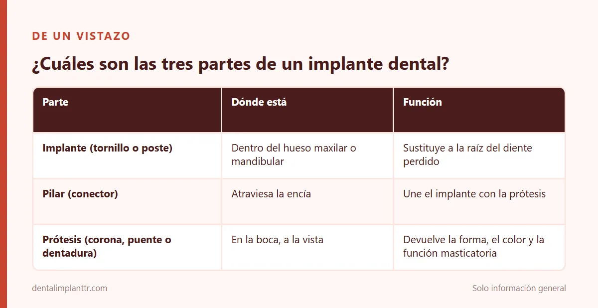 Infografía: ¿Cuáles son las tres partes de un implante dental?