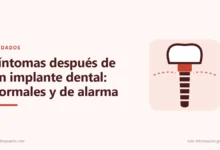 Ilustración: Síntomas después de un implante dental: normales y de alarma